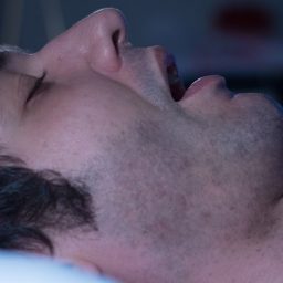 Can Sleep Apnea Cause Brain Damage?